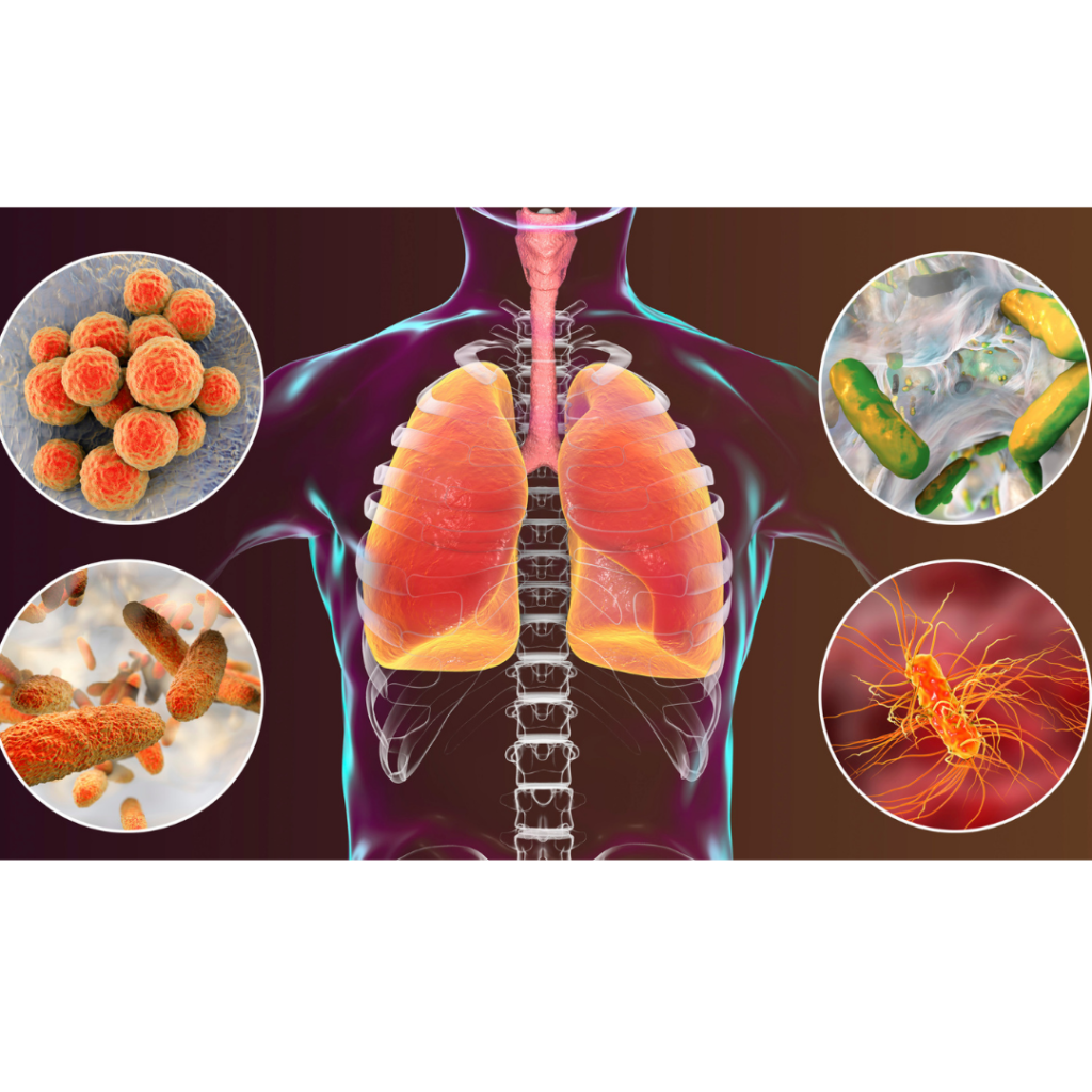 Pneumonia Gejala Punca Dan Pencegahan Tcer My