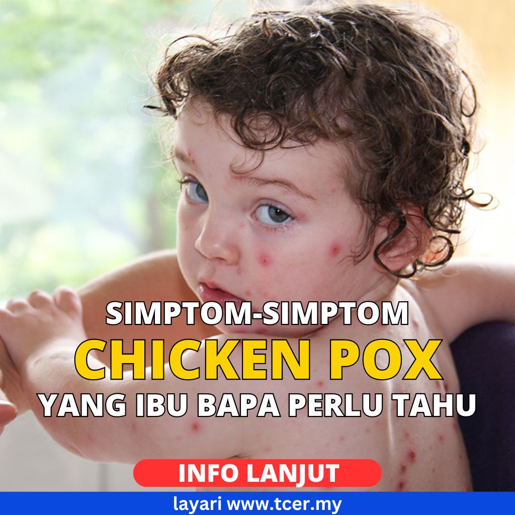 3 Fasa Chicken Pox Simptom Punca Risiko Komplikasi Rawatan TCER MY