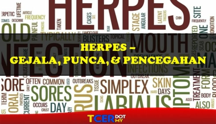 Herpes - Gejala, Punca Dan Rawatan - TCER.MY