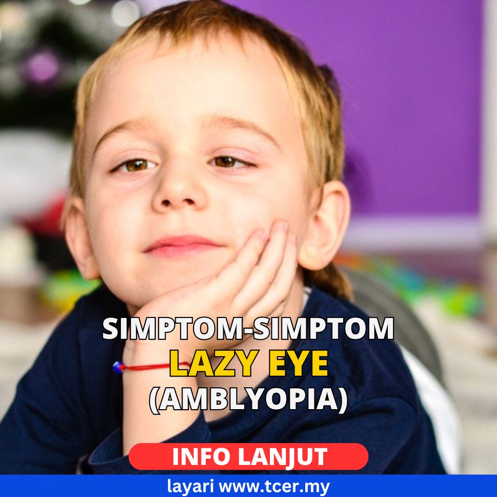 Lazy Eye (Amblyopia): Ini 3 Penyebab Utama Keadaan Ini Boleh Terjadi ...