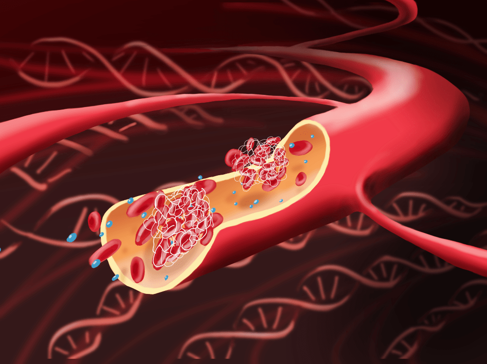 Haemophilia: Jenis, Simptom, Punca, Komplikasi, Diagnosis & Rawatan 1