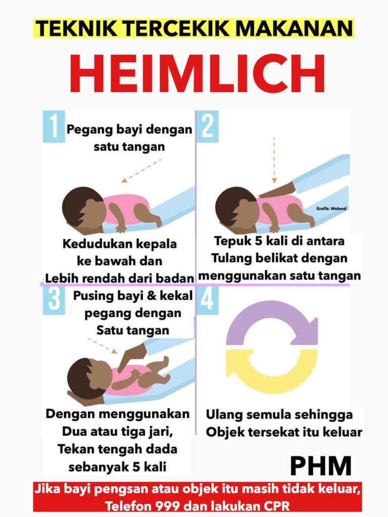 Panduan Teknik 'Heimlich Maneuver' Ketika Kecemasan Tercekik 2