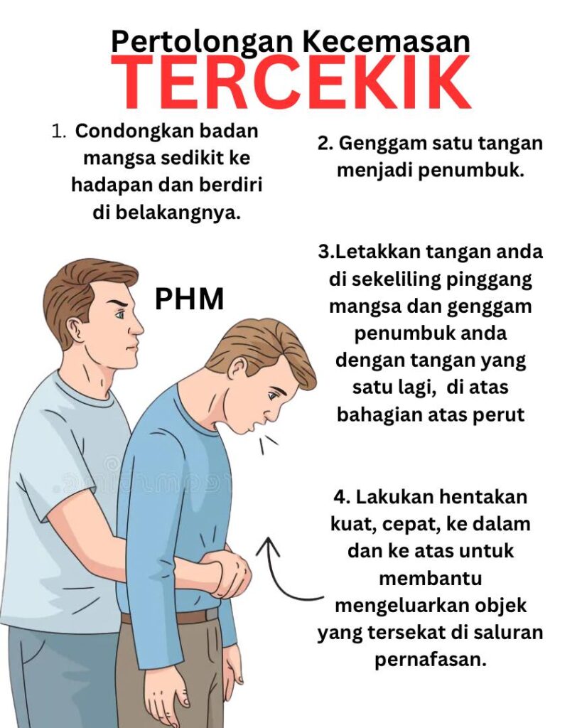 Panduan Teknik 'Heimlich Maneuver' Ketika Kecemasan Tercekik 1