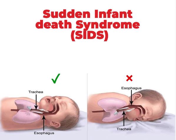 Apa Itu SIDS? Ibu Bapa Perlu Tahu Sindrom Kematian Bayi Mengejut! 1